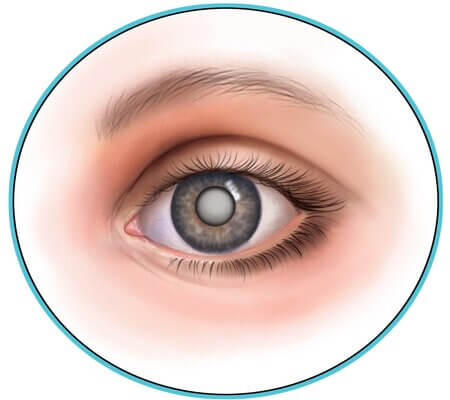 ԱԿՆԱԲՈՒԺՈՒԹՅՈՒՆ ( OPHTHALMOLOGY )