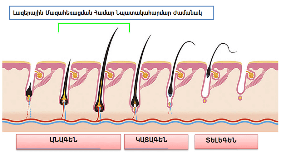 ՄԱԶԻ ԱՃԻ ՓՈՒԼԵՐԸ - ՄԱԶԱՀԵՌԱՑՈՒՄ