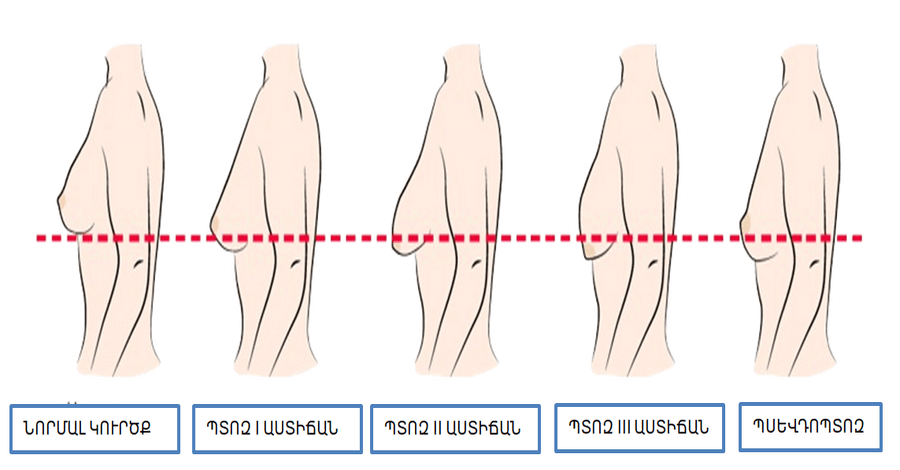 ԿՐԾՔԵՐԻ-ՁԳՈՒՄ-ԼԻՖՏԻՆԳ-VS-ԿՐԾՔԵՐԻ-ՄԵԾԱՑՈՒՄ-ԿՐԾՔԵՐԻ-ՁԳՄԱՆ-ԵՎ-ՄԵԾԱՑՄԱՆ-ՏԱՐԲԵՐՈՒԹՅՈՒՆԸ