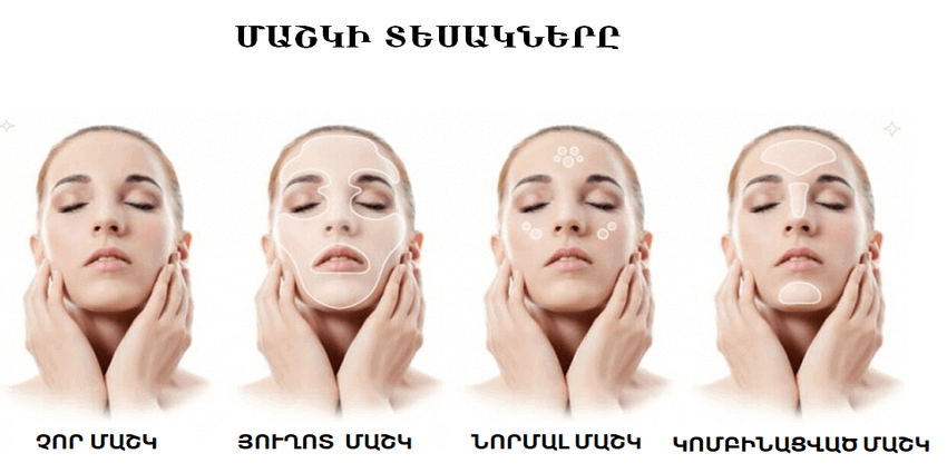 ՄԱՇԿԻ ԽՆԱՄՔ - ՅՈՒՂՈՏ ՄԱՇԿ